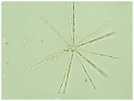Asterionella formosa 