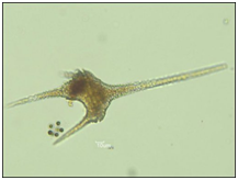 Ceratium hirundinella