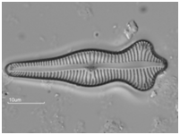 Gomphonema acuminatum